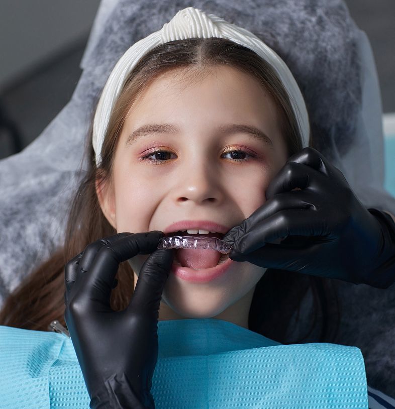 Dental Crown Types