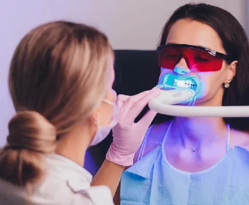 How Long Does Professional Teeth Whitening Last