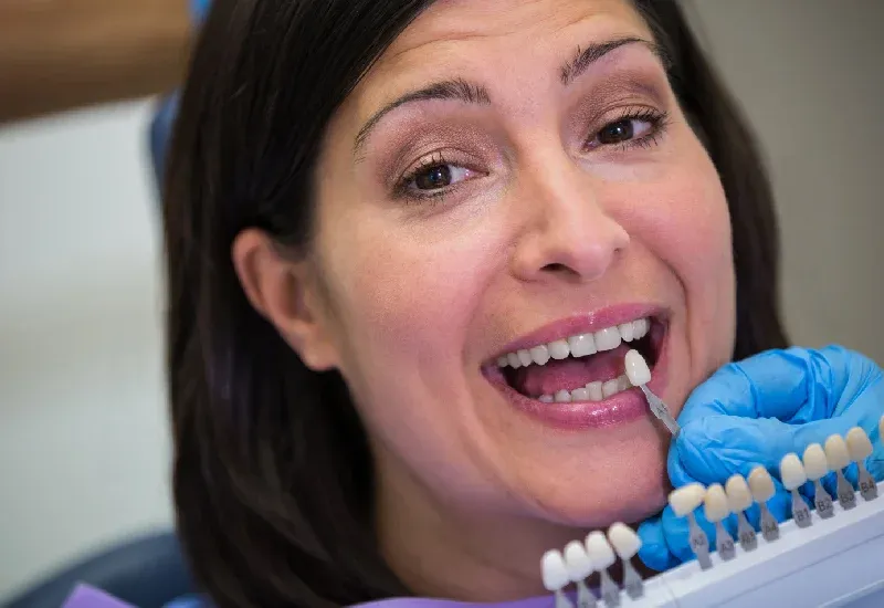 How Veneers Fix Chips, Gaps, & Uneven Teeth