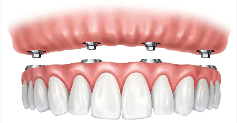 Happy patient pointing to smile